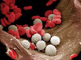 Повышенные лейкоциты в крови