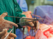 Жена подарила мужу почку на юбилей