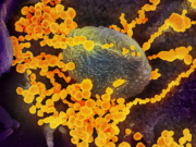 Описаны отличия штамма коронавируса в России