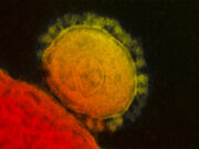 В США рассказали о «зловещих щупальцах» коронавируса