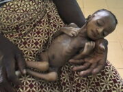 Стало известно о массовом голоде среди детей из-за пандемии