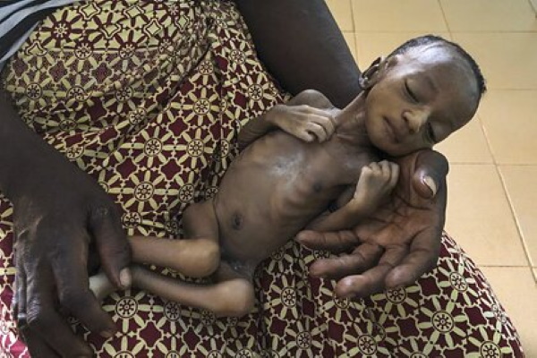 Стало известно о массовом голоде среди детей из-за пандемии