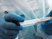 В Подмосковье провели более 1,4 млн тестов на коронавирус