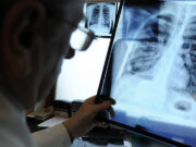 Москву охватила пневмония