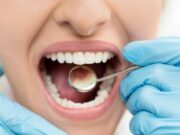 Как избавиться от кариеса? Эффективные методики лечения