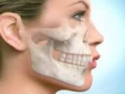 Неправильный прикус: последствия и способы исправления