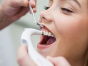 Гигиеническая чистка зубов: что это такое? Её преимущества и особенности