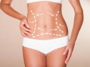 Пластическая хирургия: особенности подготовки и реабилитации