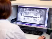 Что такое томография зубов? Показания к проведению, особенности и подготовка