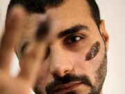 Прыщ на левой брови у мужчин: примета или миф