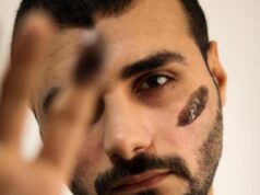 Прыщ на левой брови у мужчин: примета или миф