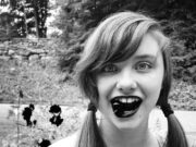 Сонник: черные зубы и их выпадение