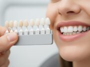 Полный обзор методов протезирования зубов