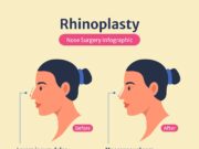 Определение формы носа